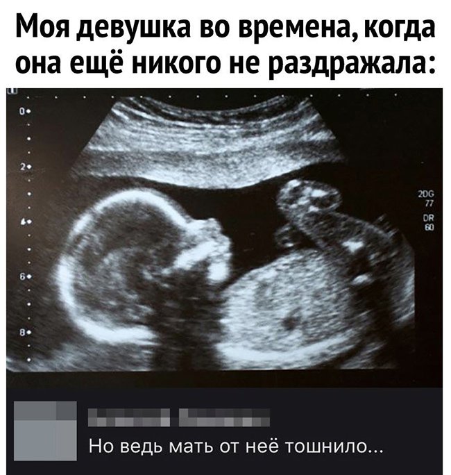 Девушка никого не раздражала в утробе матери